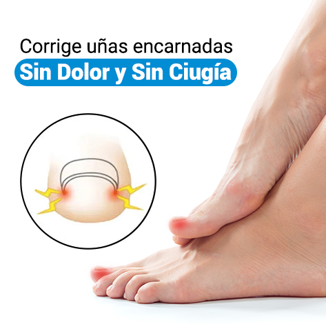 Corrige uñas encarnadas sin dolor y sin cirugía