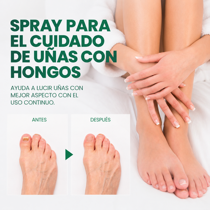 Kera Pass: La fórmula en spray para el cuidado profundo de uñas con hongos
