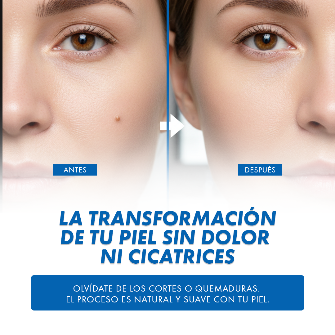 Parches Removedores de Verrugas – Pack 144 Unidades