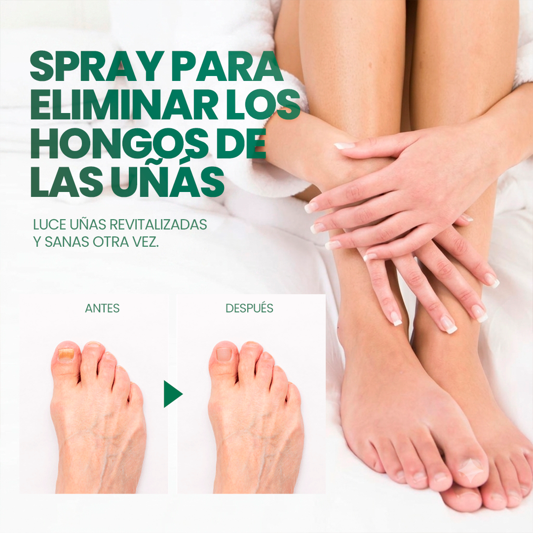 Kera Pass: La fórmula en spray que atraviesa la uña y elimina el hongo desde la raíz