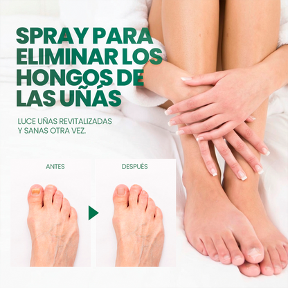 Kera Pass: La fórmula en spray que atraviesa la uña y elimina el hongo desde la raíz