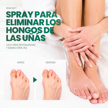 KeraPass: El spray que atraviesa la queratina y llega a la raíz del hongo