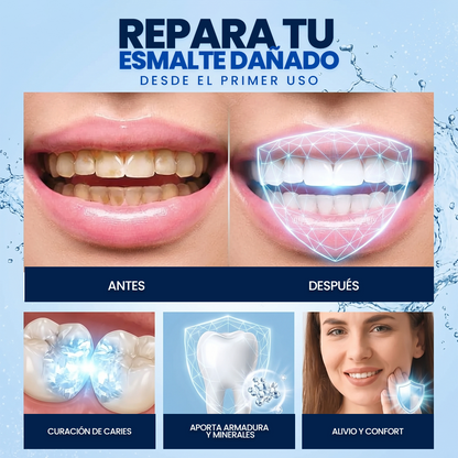Dental Cavity Healing: La revolución dental para una sonrisa perfecta sin sensibilidad